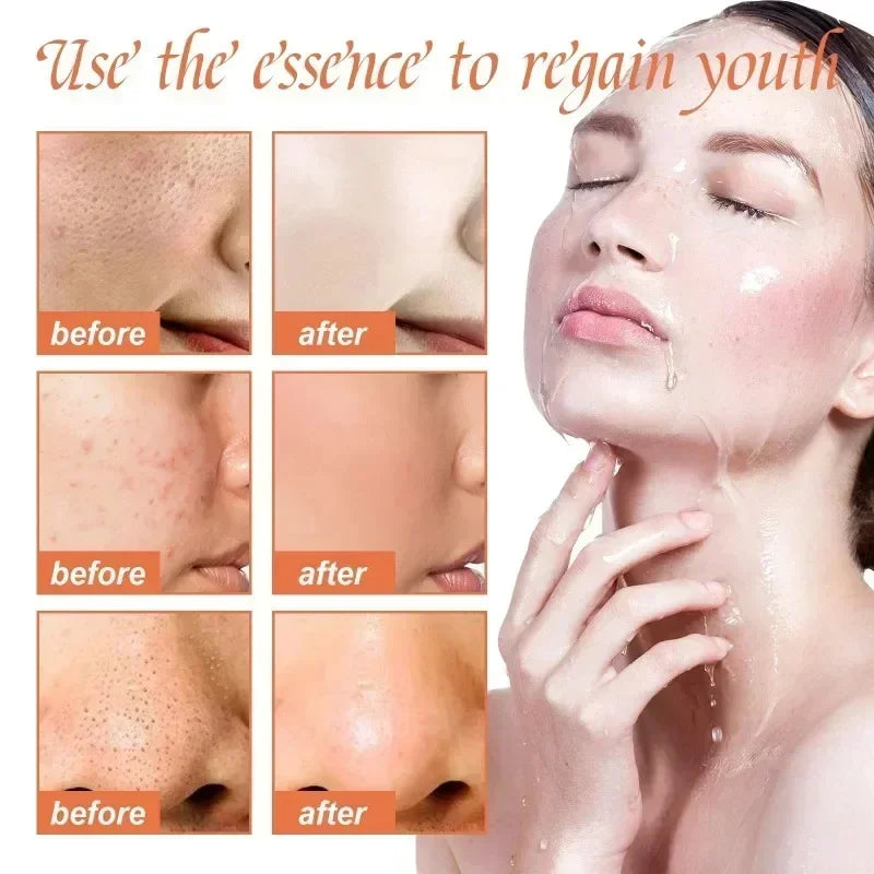 Face Pore Shrinking Serum Removing Large Pores Tightening Skin Get Rid Of Acne Marks  Repairing Facial Pore Minimizing Essence