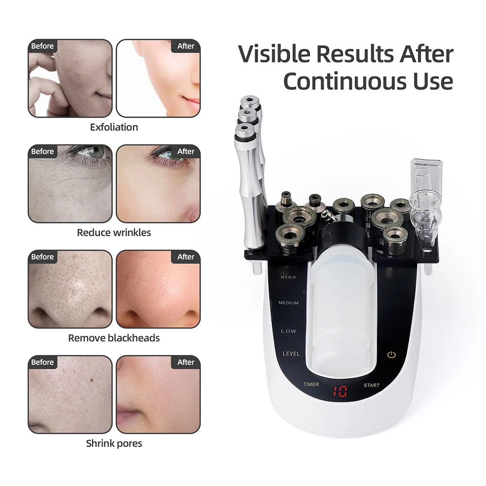 Home Use Facial Diamond Microdermabrasion Machine Professional - Skin Care