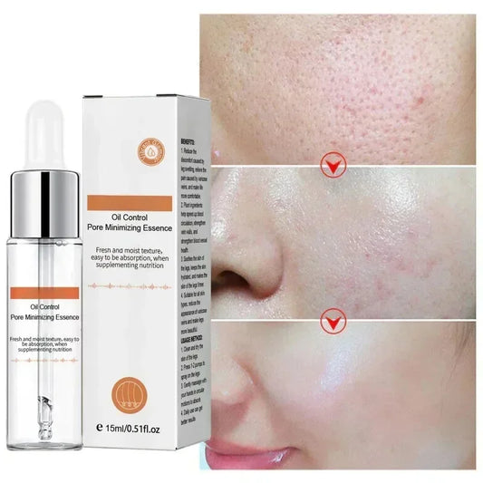 Face Pore Shrinking Serum Removing Large Pores Tightening Skin Get Rid Of Acne Marks  Repairing Facial Pore Minimizing Essence