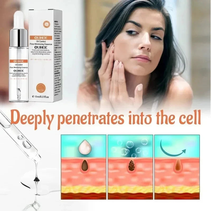 Face Pore Shrinking Serum Removing Large Pores Tightening Skin Get Rid Of Acne Marks  Repairing Facial Pore Minimizing Essence