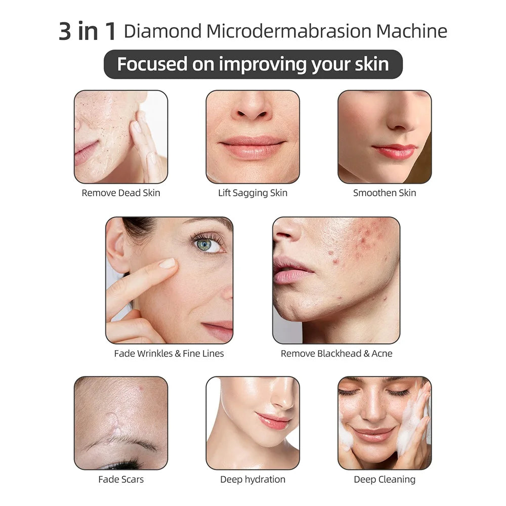 Home Use Facial Diamond Microdermabrasion Machine Professional - Skin Care