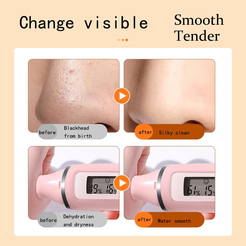 Face Cleaning Bubble Mask Shrinking Pore Remove Blackhead Deep Cleansing Oil Control Anti-Acne Brighten Whitening Face Skin Care