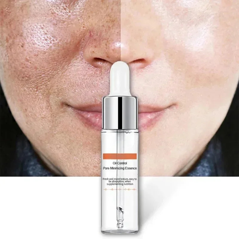 Face Pore Shrinking Serum Removing Large Pores Tightening Skin Get Rid Of Acne Marks  Repairing Facial Pore Minimizing Essence