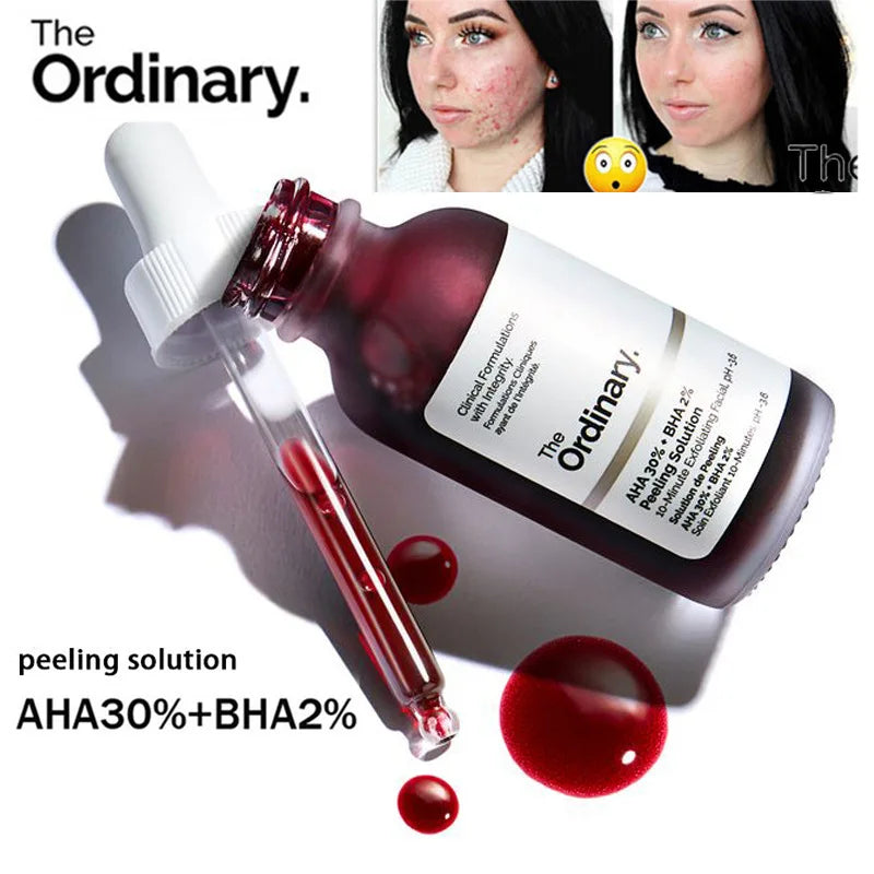 Fruit acid AHA 30% + BHA 2% exfoliating liquid facial essence salicylic acid moisturizing facial